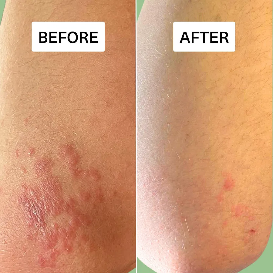 Therapeutic CBD Skin Balm 50 ml 