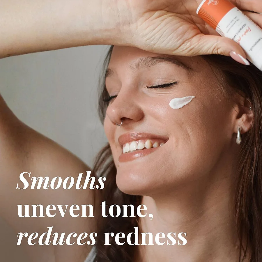 Skin Perfection Azelaic Serum 30 ml